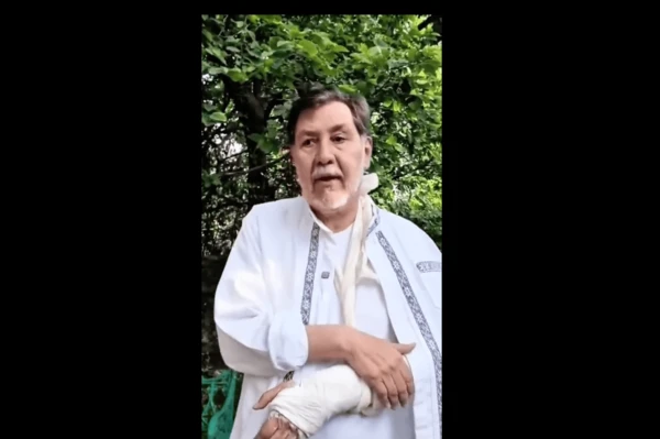 ¿Qué le pasó a Noroña? Político aparece con una fractura en el brazo