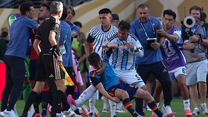 Momentos polémicos de los jugadores argentinos en la Final del Mundial 2026 Estos fueron los momentos más polémicos que dejaron los jugadores argentinos durante la Final de la Copa del Mundo 2026. Foto: EFE